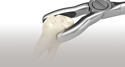 抜けた歯をできるだけ残す・移す治療