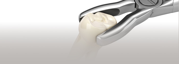 抜けた歯をできるだけ残す・移す治療